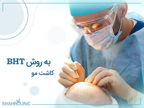 کاشت مو به روش BHT