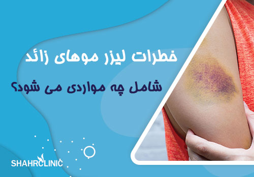 خطرات لیزر موهای زائد شامل چه مواردی می‌شود؟