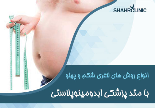 انواع روش‌ های لاغری شکم و پهلو با متدهای پزشکی