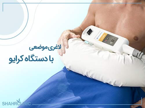 لاغری موضعی با دستگاه کرایو