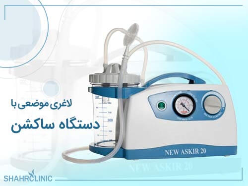 لاغری موضعی با دستگاه ساکشن بدون نیاز به جراحی