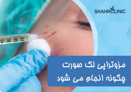  مزوتراپی لک صورت چگونه انجام می شود؟