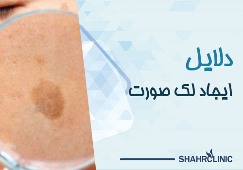 دلایل ایجاد لک صورت