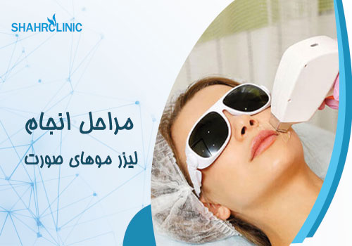  مراحل لیزر صورت زنان و مردان