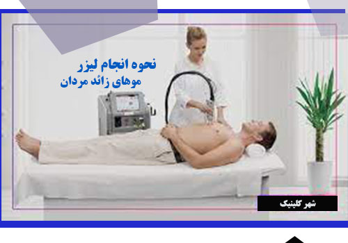 نحوه انجام فرایند لیزر موهای زائد آقایان