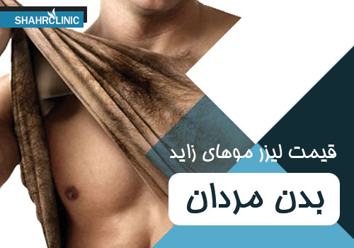 قیمت لیزر موهای زائد بدن مردان