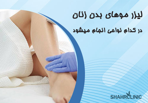 لیزر موهای بدن زنان در کدام نواحی انجام می‌شود؟