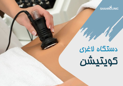 دستگاه لاغری کویتیشن