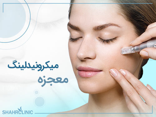 معجزه میکرونیدلینگ