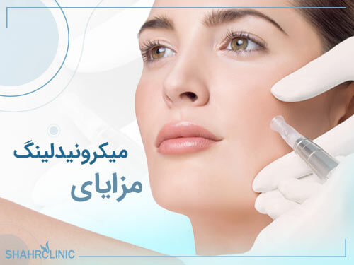 مزایای میکرونیدلینگ