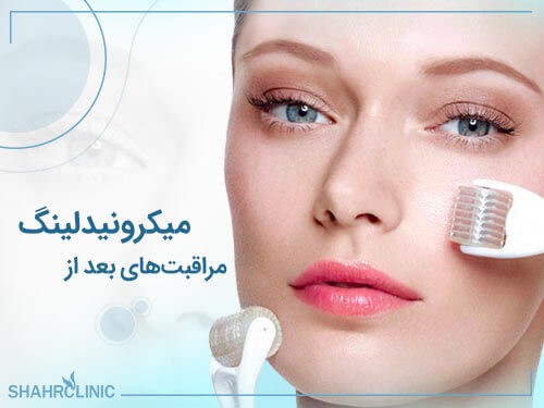 مراقبت های بعد از میکرونیدلینگ