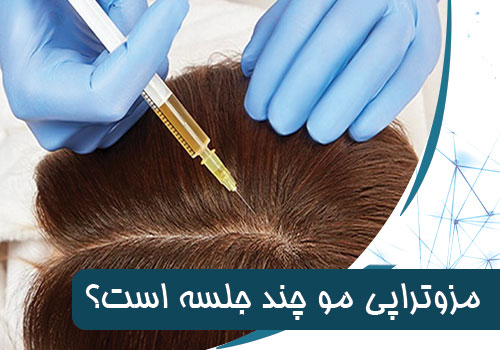 مزوتراپی مو چند جلسه است