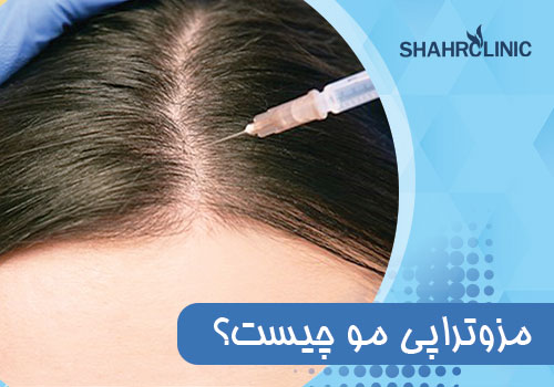 مزوتراپی مو چیست؟