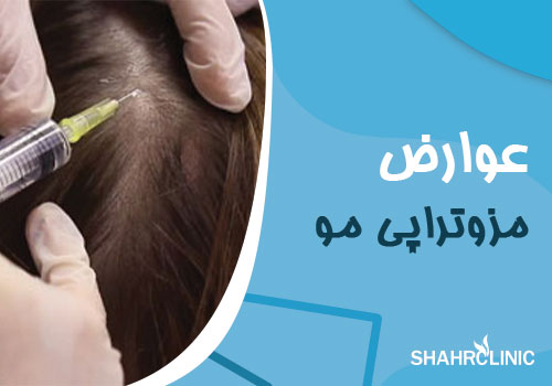 عوارض مزوتراپی مو