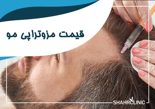 هزینه و قیمت مزوتراپی مو