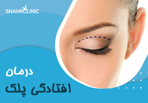 درمان افتادگی پلک
