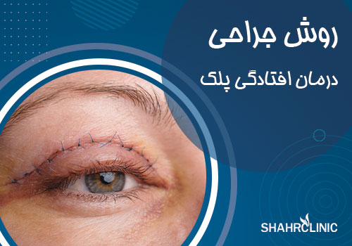 روش جراحی در افتادگی پلک
