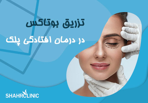 تزریقبوتاکس در افتادگی پلک