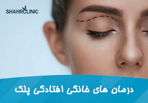 درمان‌های خانگی و طبیعی افتادگی پلک