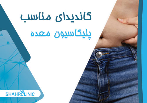 چه کسانی کاندید مناسبی برای پلیکاسیون معده مناسب هستند؟