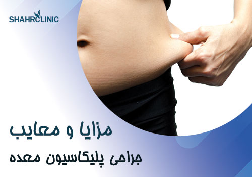 مزایای و معایب جراحی پلیکاسیون معده