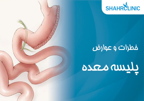 خطرات و عوارض پلیسه معده چیست؟