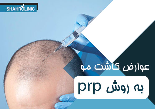عوارض کاشت مو به روش PRP