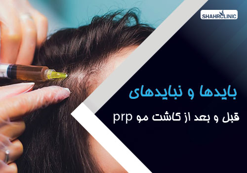 بایدها و نبایدهای قبل و بعد از کاشت مو به روش PRP