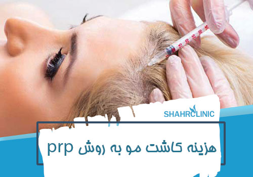 هزینه کاشت مو به روش prp