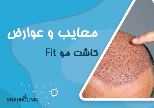 معایب عوارض کاشت مو