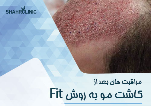 مراقبت های بعد از کاشت مو به روش fit