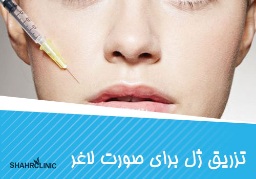 تزریق ژل برای صورت لاغر
