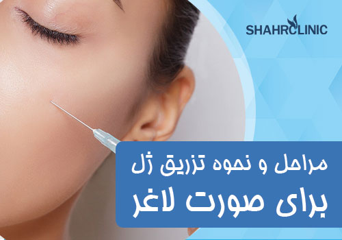 مراحل و نحوة تزریق ژل برای صورت لاغر