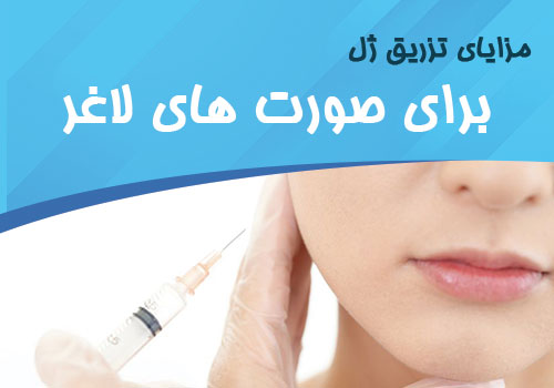 مزایای تزریق ژل به صورت‌های لاغر