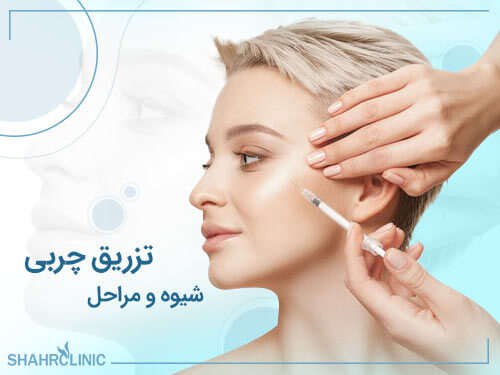 شیوه و مراحل تزریق چربی