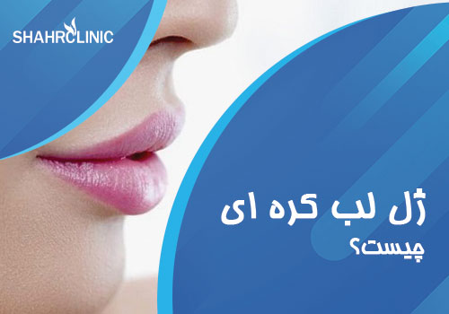 ژل لب کره ایی