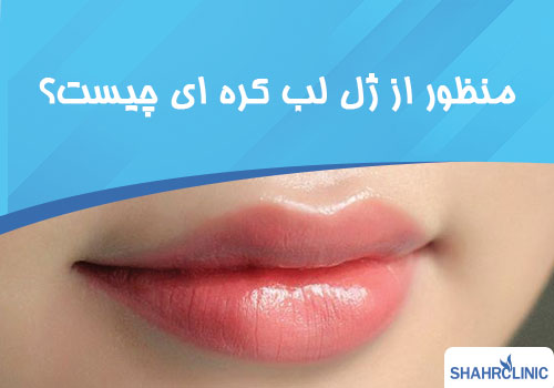 منظور از تزریق ژل لب