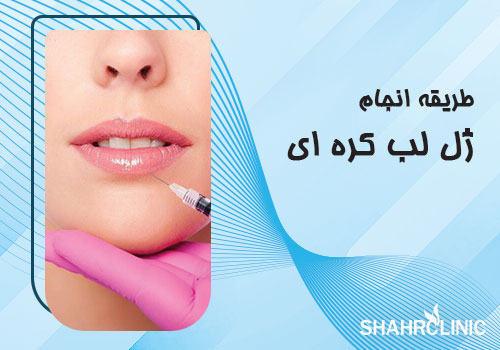 طریقه انجام ژل لب کره ایی