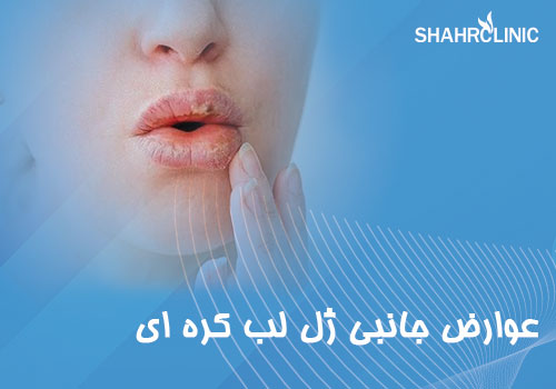 عوارض جانبی ژل لب کره‌ای