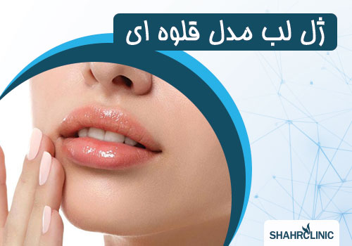 ژل لب قلوه ایی