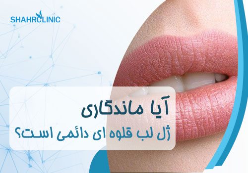 ایا يل لب قلوه ایی دایمی است