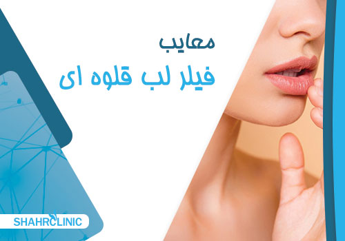 فیلر لب قلوه