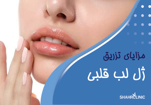 مزایای تزریق ژل لب مدل قلبی