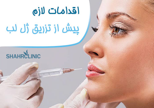 اقدامات لازم \یش از تزریق ژل لب