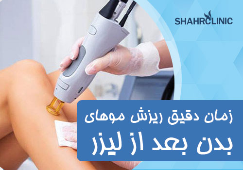 زمان دقیق ریزش موهای بدن بعد از لیزر