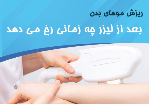 ریزش موهای بدن بعد از لیزر در چه زمانی رخ می‌دهد؟