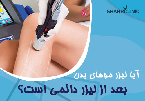 آیا ریزش موهای بدن بعد از لیزر دائمی است؟