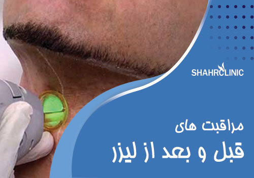 مراقبت های قبل و بعد از لیزر